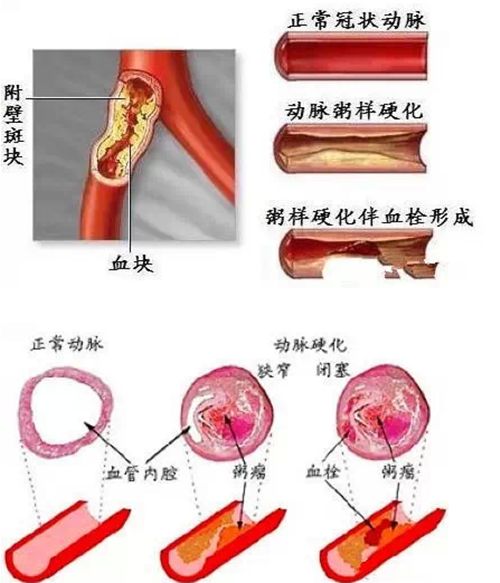 凈水器租賃 凈水器租賃
